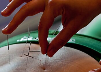 Robyn Verdel Acupuncture