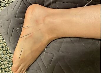 Essential Acupuncture Clinic