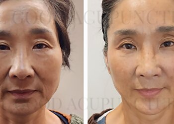 Feel Good Acupuncture