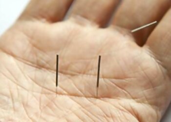 Xin Gu Chinese Acupuncture and Muscle Massage